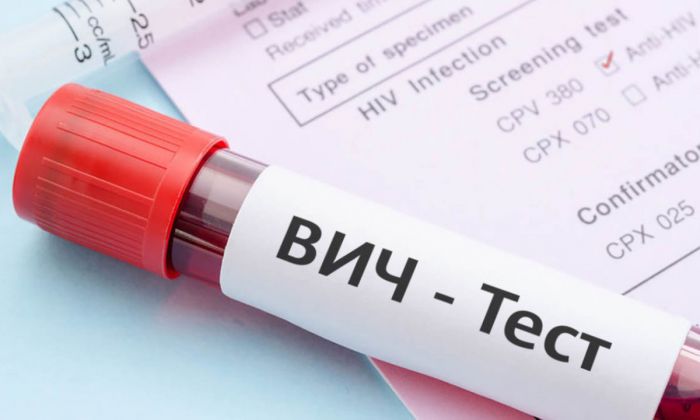 Профилактическая акция по тестированию на ВИЧ-инфекцию пройдет в Могилеве с 25 по 29 апреля