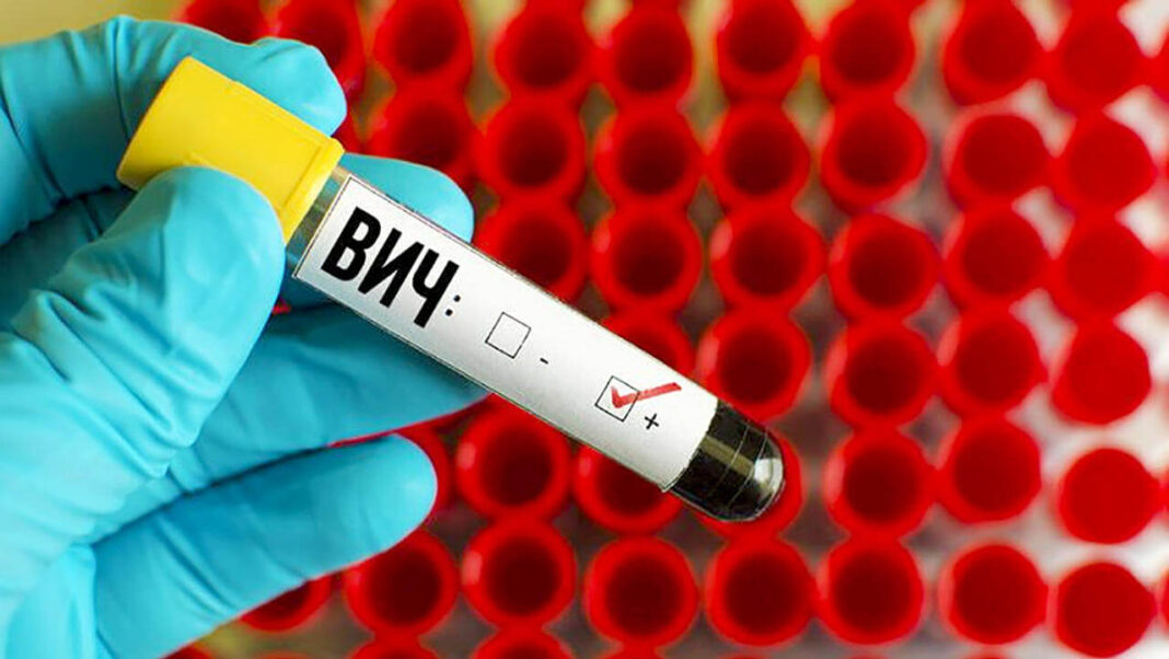 Врачи-инфекционисты - о ситуации с ВИЧ/СПИД в Осиповичском районе на 1 октября 2022 года